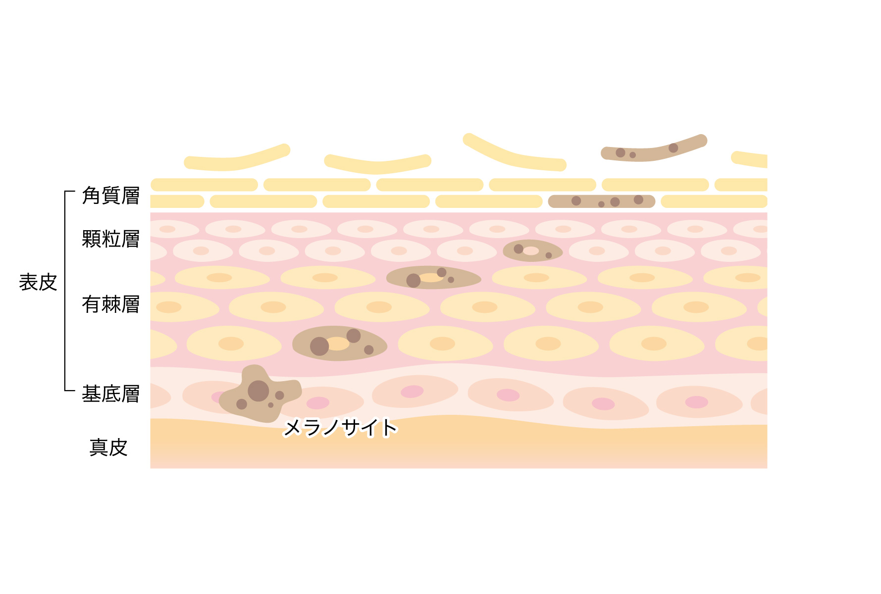 画像名