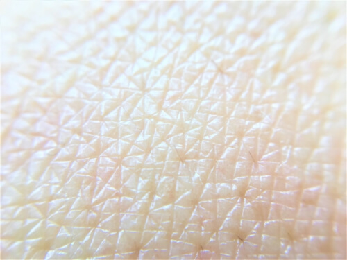 角質